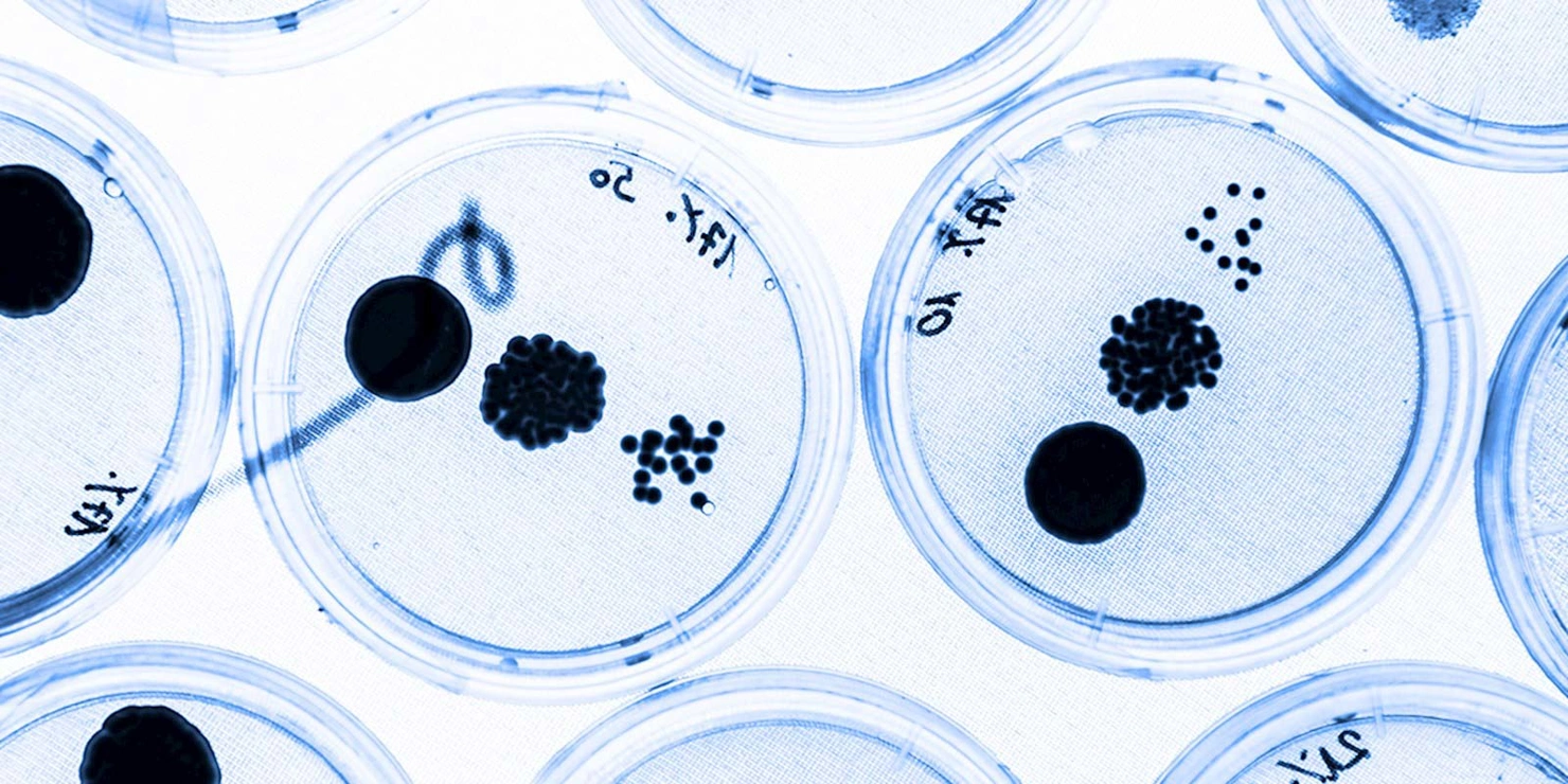 Laboratory petri dishes in a microbiology lab
